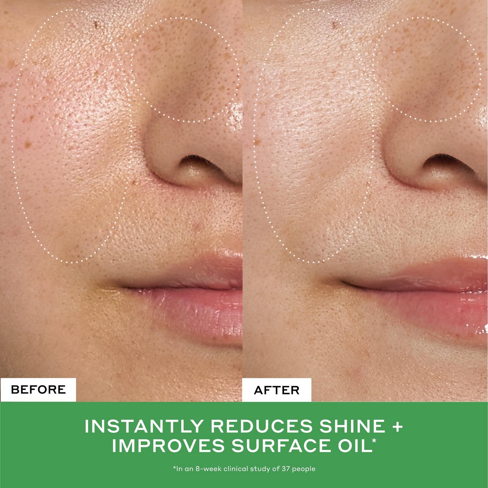 Detox Drops 2% Salicylic Acid Acne Toner