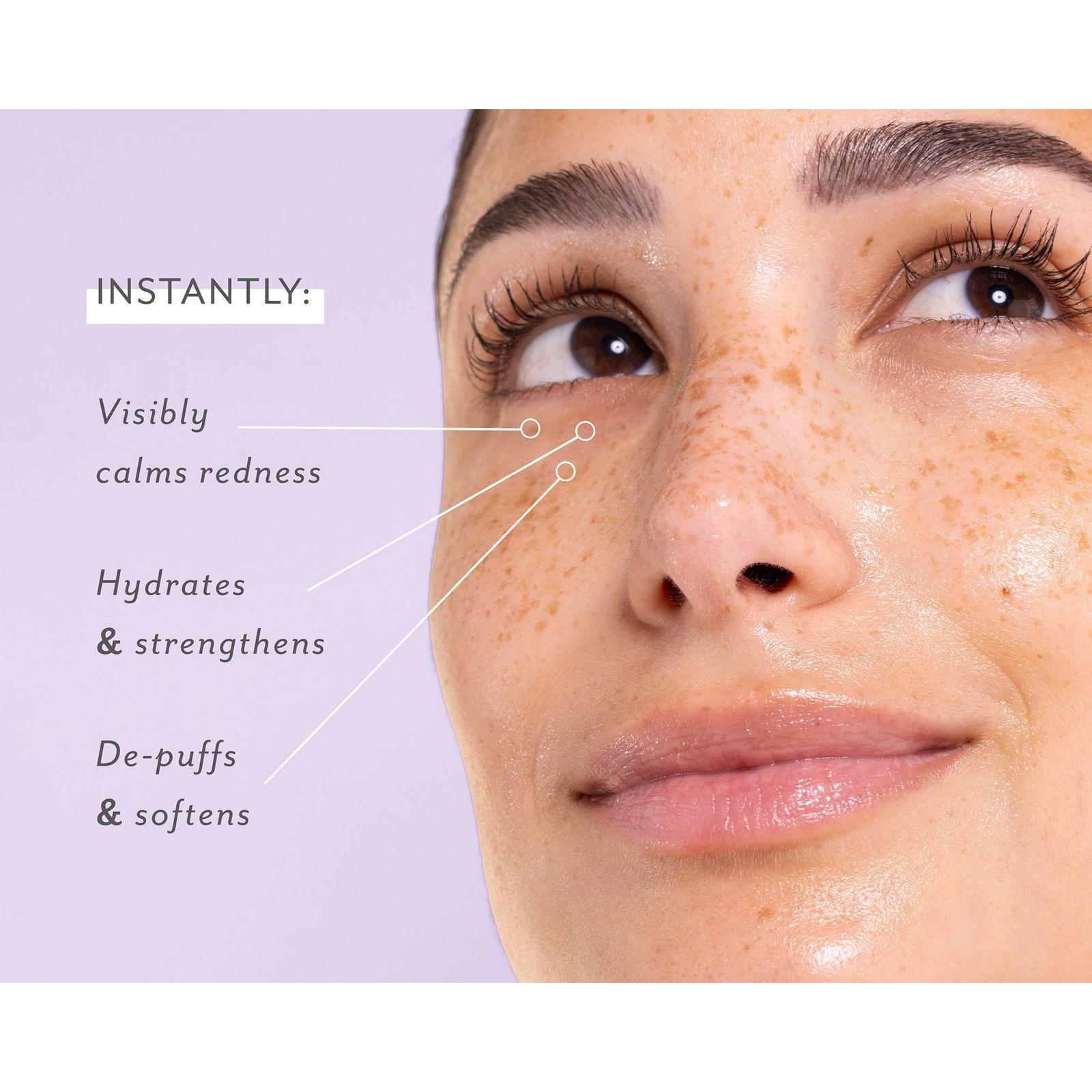 Skin Remedy Soothing Eye Gels