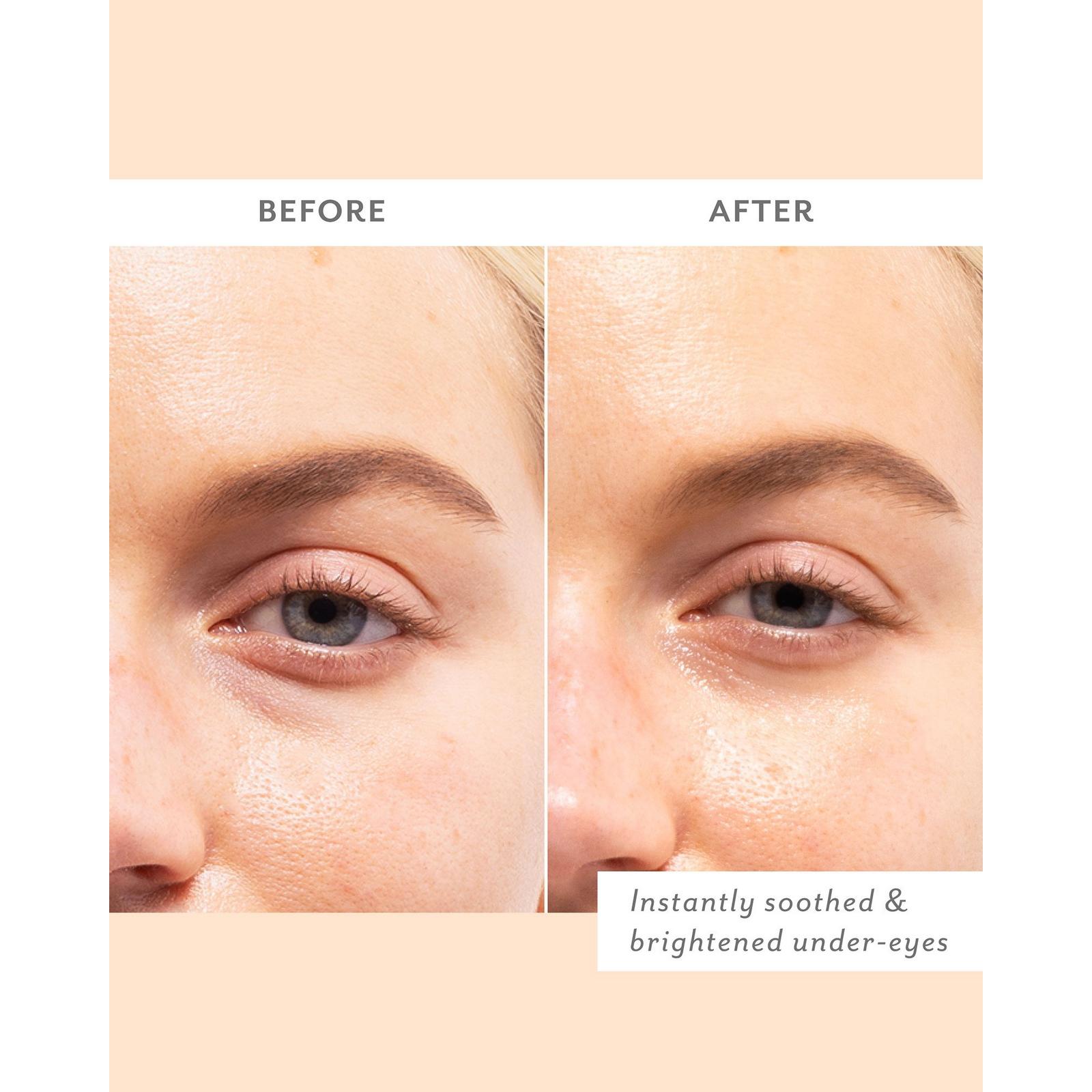 Skin Remedy Soothing Eye Gels