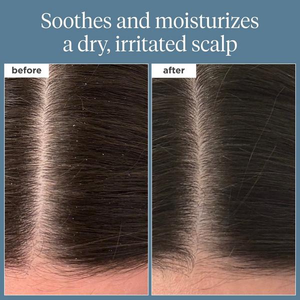 Briogeo Travel Size Scalp Revival Rosemary Pre-Wash Oil #7