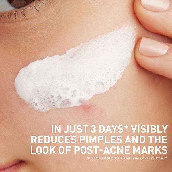 CeraVe Acne Clay-to-Foam Facial Cleanser #7