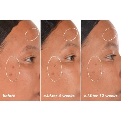 Bright Icon Vitamin C + E + Ferulic Serum