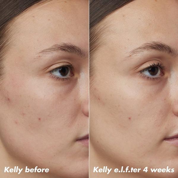 e.l.f. Cosmetics PLZ Clarify Facial Oil #3