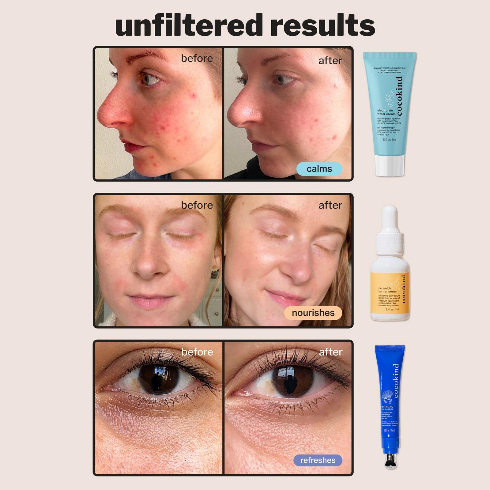 Hydration Heroes Kit