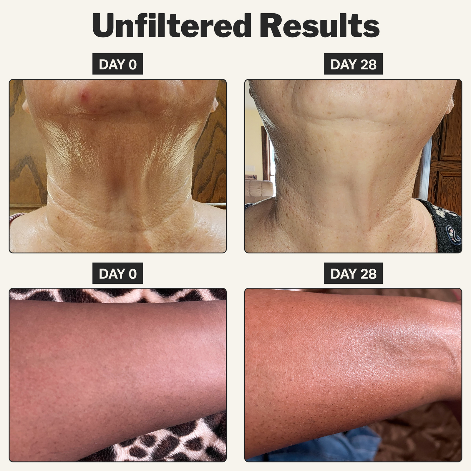 Retinol Body Cream