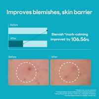 MEDIHEAL - Madecassoside Blemish Repair Serum | Ulta Beauty