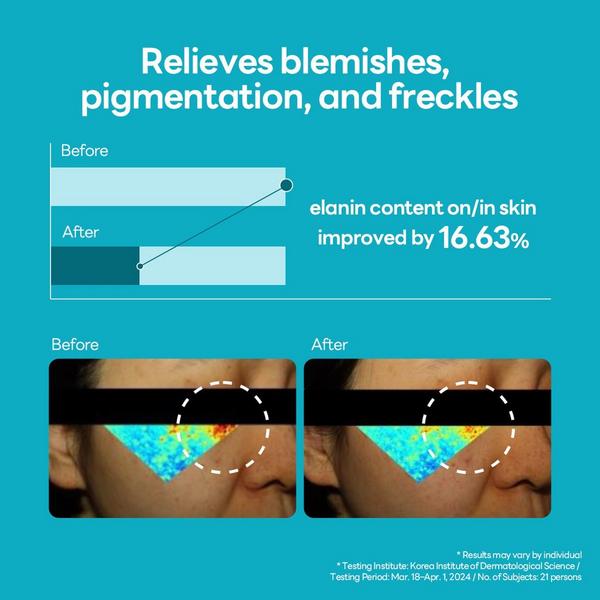MEDIHEAL Madecassoside Blemish Repair Serum #5