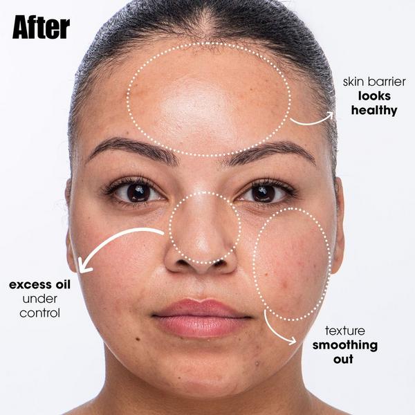 SUNDAY RILEY Breakout Breakup Purifying Salicylic Acid Cleanser #3