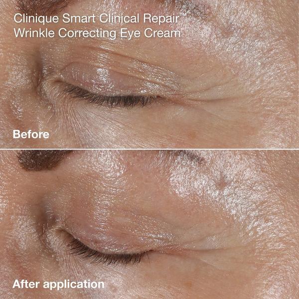 Clinique Wrinkle Fighting Routine Anti-Aging Skincare Gift Set #6