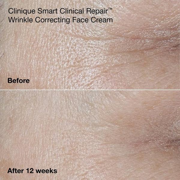 Clinique Wrinkle Fighting Routine Anti-Aging Skincare Gift Set #8
