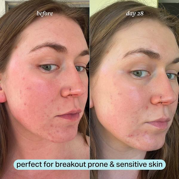 cocokind Calming Magnesium Facial Mist #3