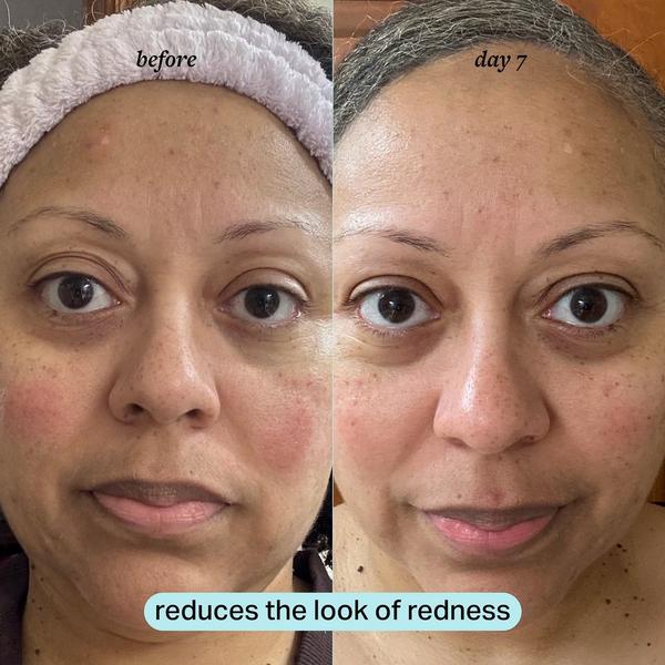 cocokind Calming Magnesium Facial Mist #4