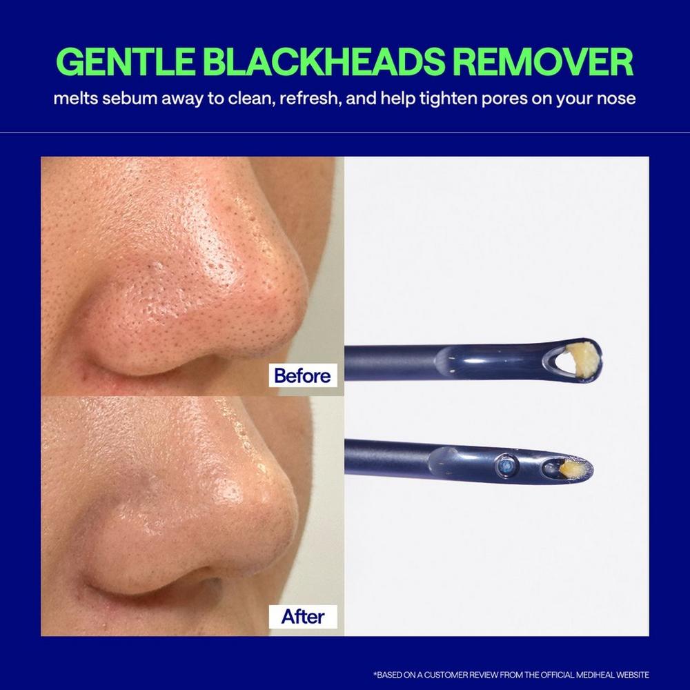 Blackhead Melting Clear Nose Patch
