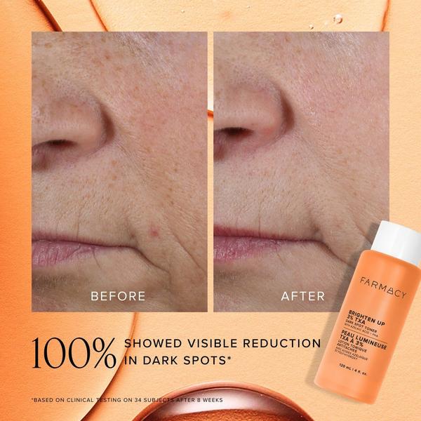 FARMACY Mini Brighten Up 3% TXA Dark Spot Toner #5