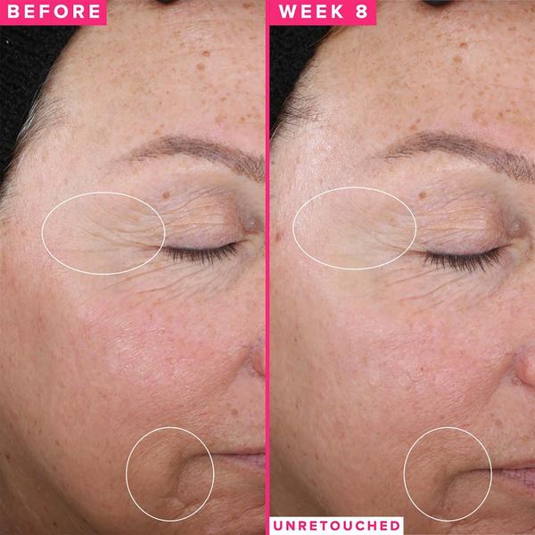 FARMACY 1% Vitamin A Retinol Serum #4