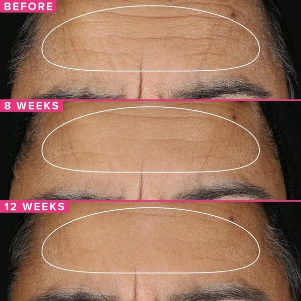FARMACY 1% Vitamin A Retinol Serum #5