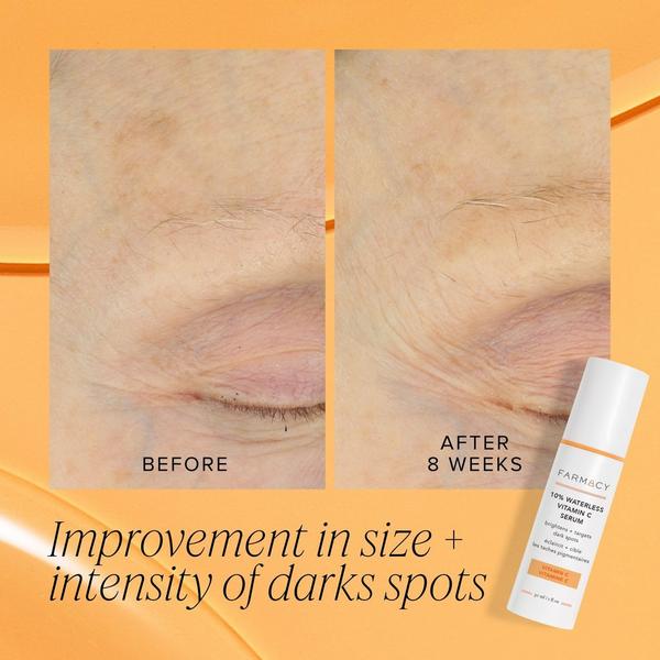 FARMACY 10% Waterless Vitamin C Serum #5
