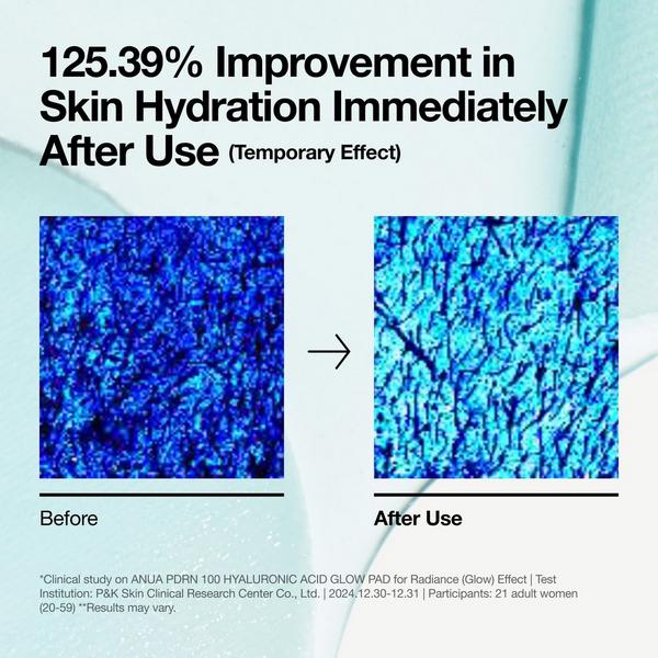 ANUA PDRN 100 Hyaluronic Acid Glow Pad #7