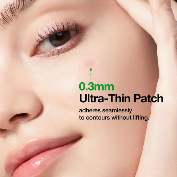ANUA Triple Acid Spot Care Microdart Patch #6