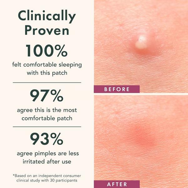 Rael Glow and Go Miracle Patch Kit #3