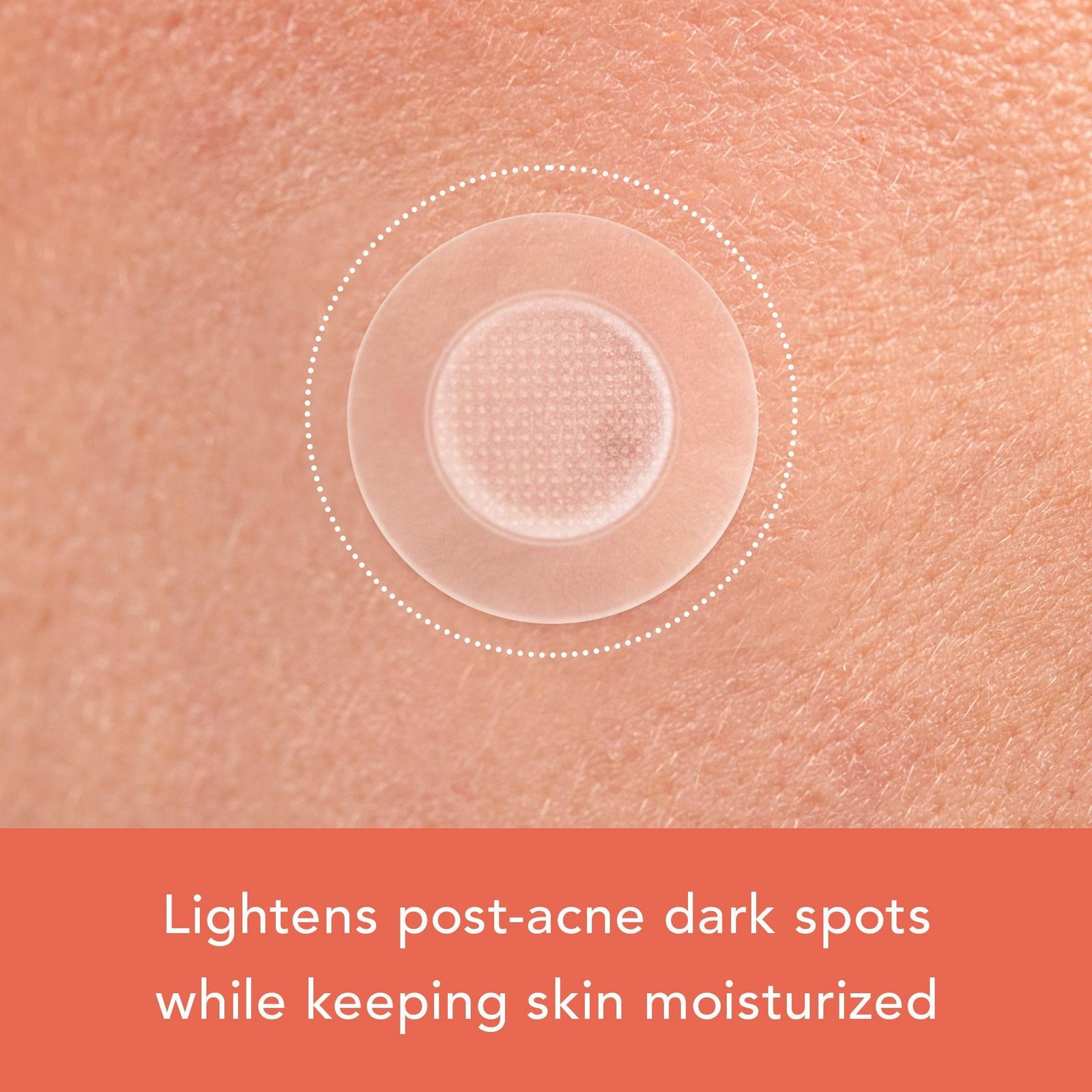 Vitamin C Dark Spot Corrector