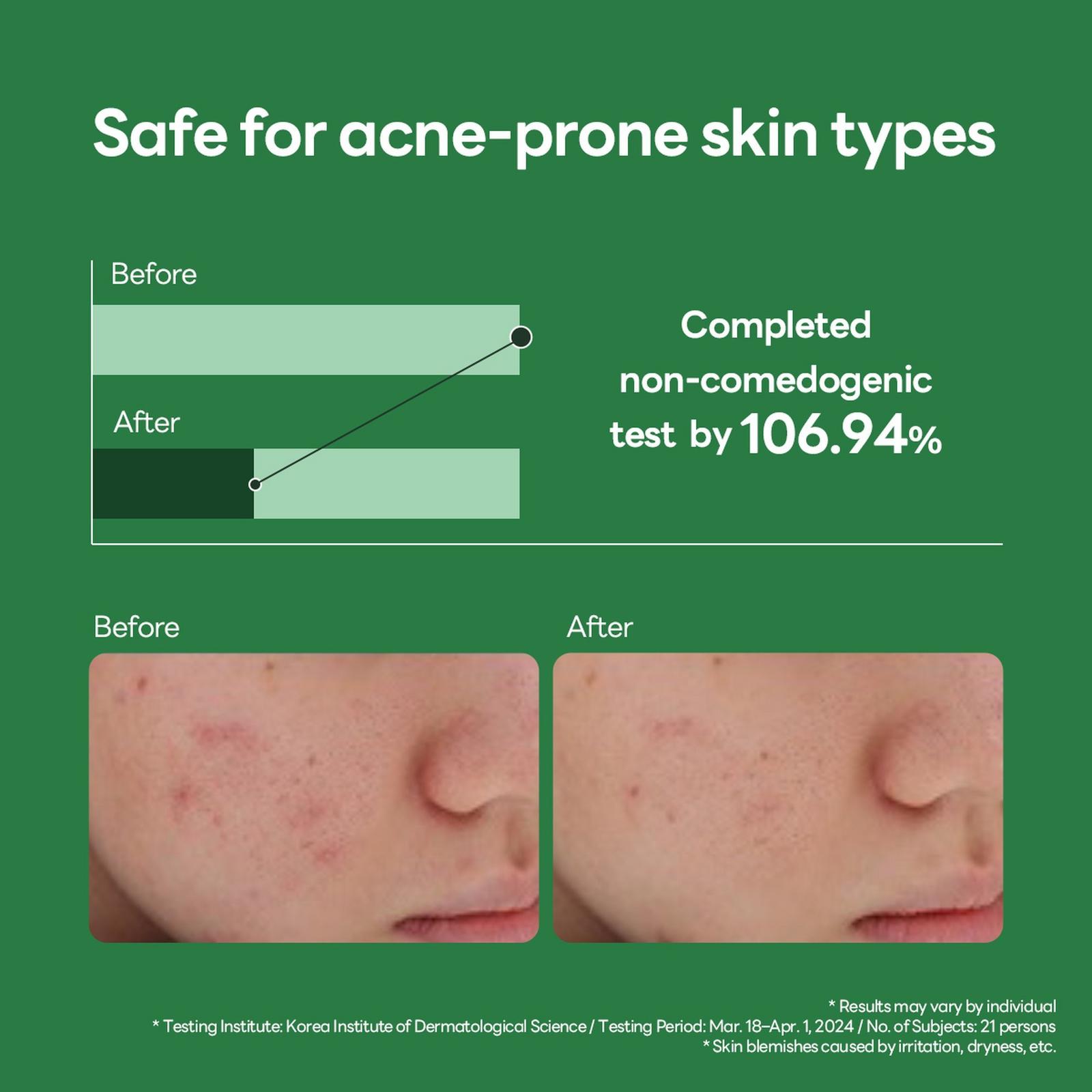 Teatree Calming Hydra Serum