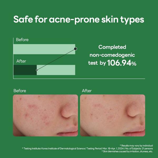 MEDIHEAL Teatree Calming Hydra Serum #4