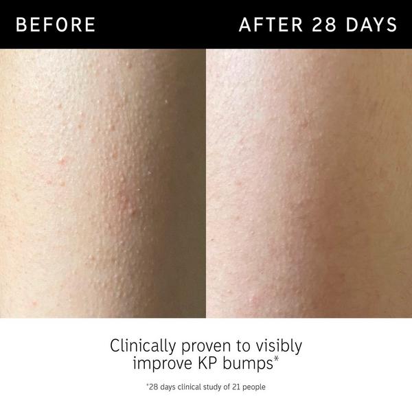 INKEY Glycolic Acid Exfoliating Body Stick #4