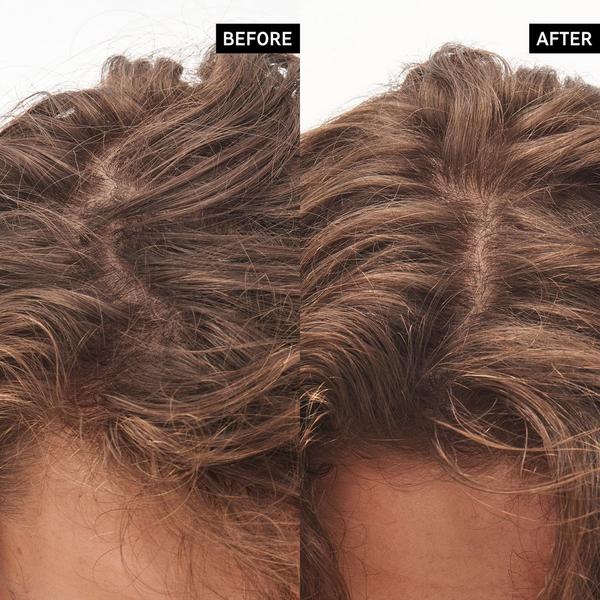 INKEY Glycolic Acid Exfoliating Scalp Scrub #6