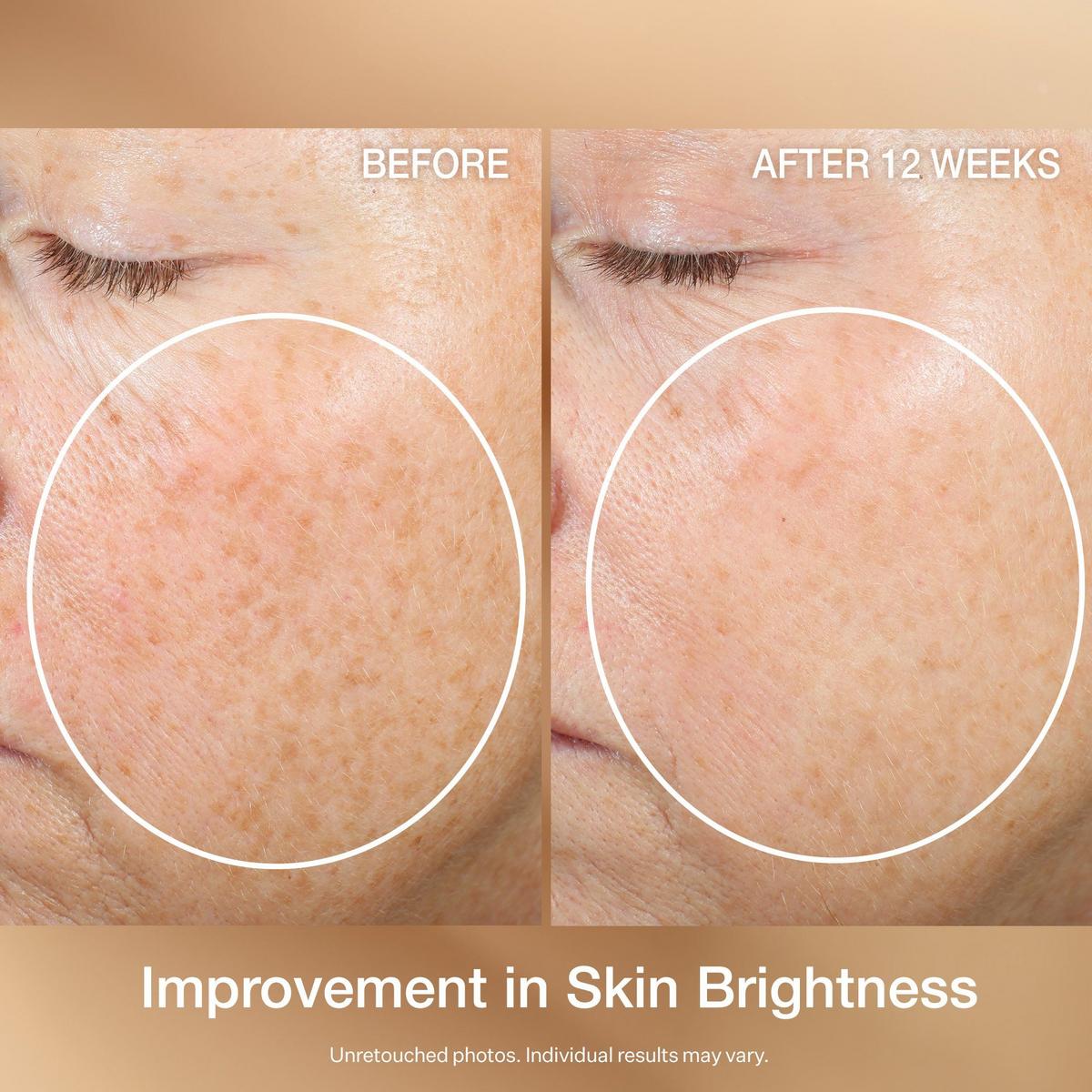 Super-C Retinol Brighten & Correct Vitamin C Serum - 1.7 oz