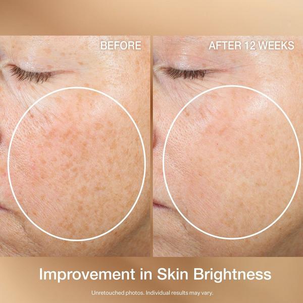StriVectin Super-C Retinol Brighten & Correct Vitamin C Serum #3