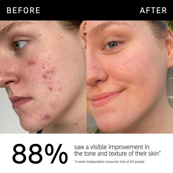 INKEY 15% Vitamin C & EGF Brightening Serum #4
