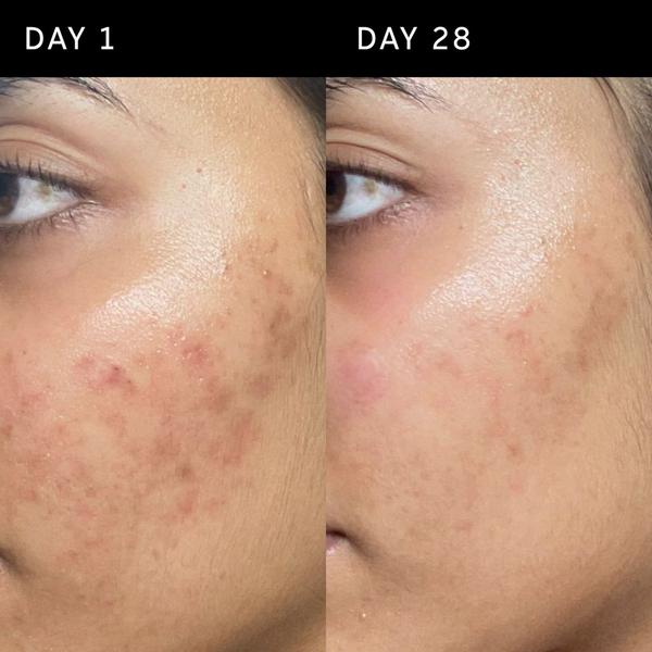 INKEY Ectoin Hydro-Barrier Serum #7