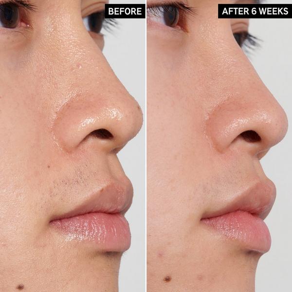 INKEY Polyhydroxy Acid Gentle Exfoliating Toner #3