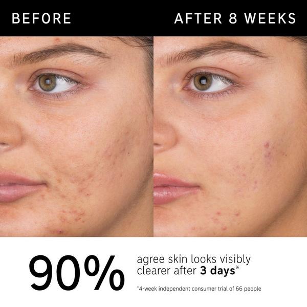 INKEY Salicylic Acid Acne + Blackhead Cleanser #4