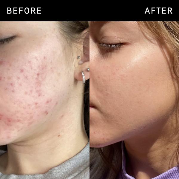 INKEY Niacinamide Oil Control Serum #4