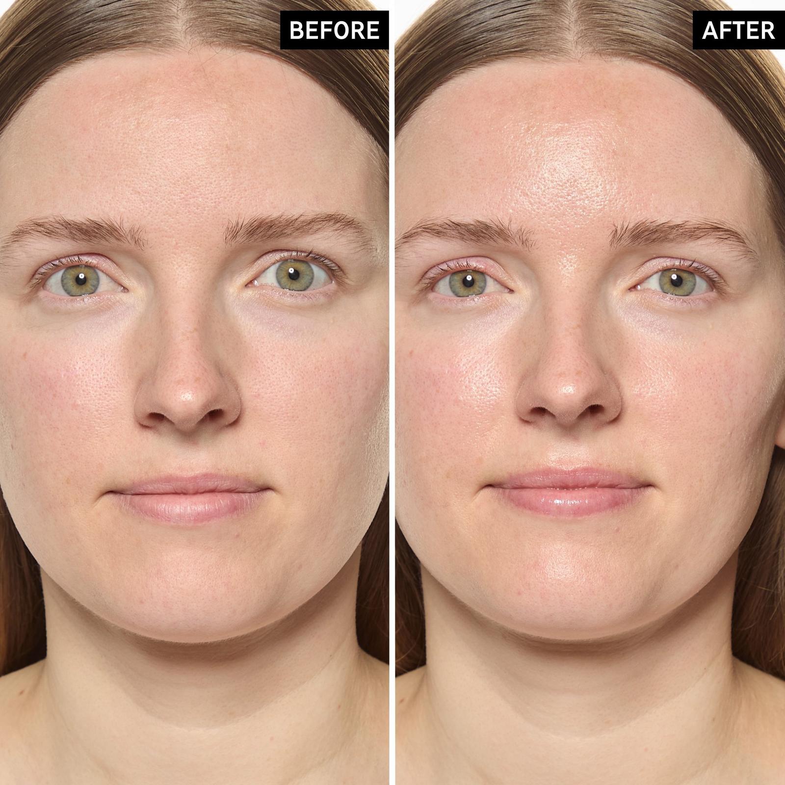 Exosome Hydro-Glow Complex Serum