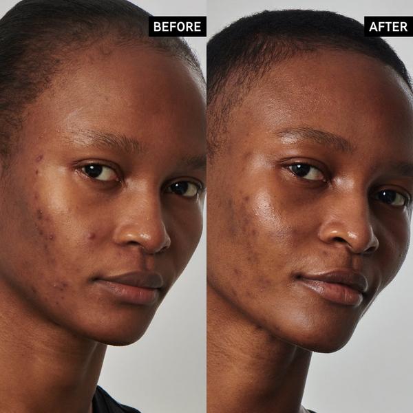 INKEY SuperSolutions 20% Niacinamide Serum #4