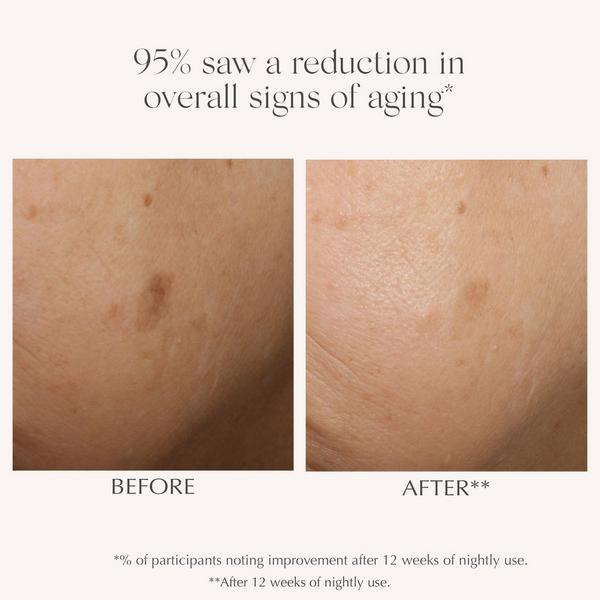 Exuviance AGE REVERSE+ Advanced Renewal Retinol Serum #2