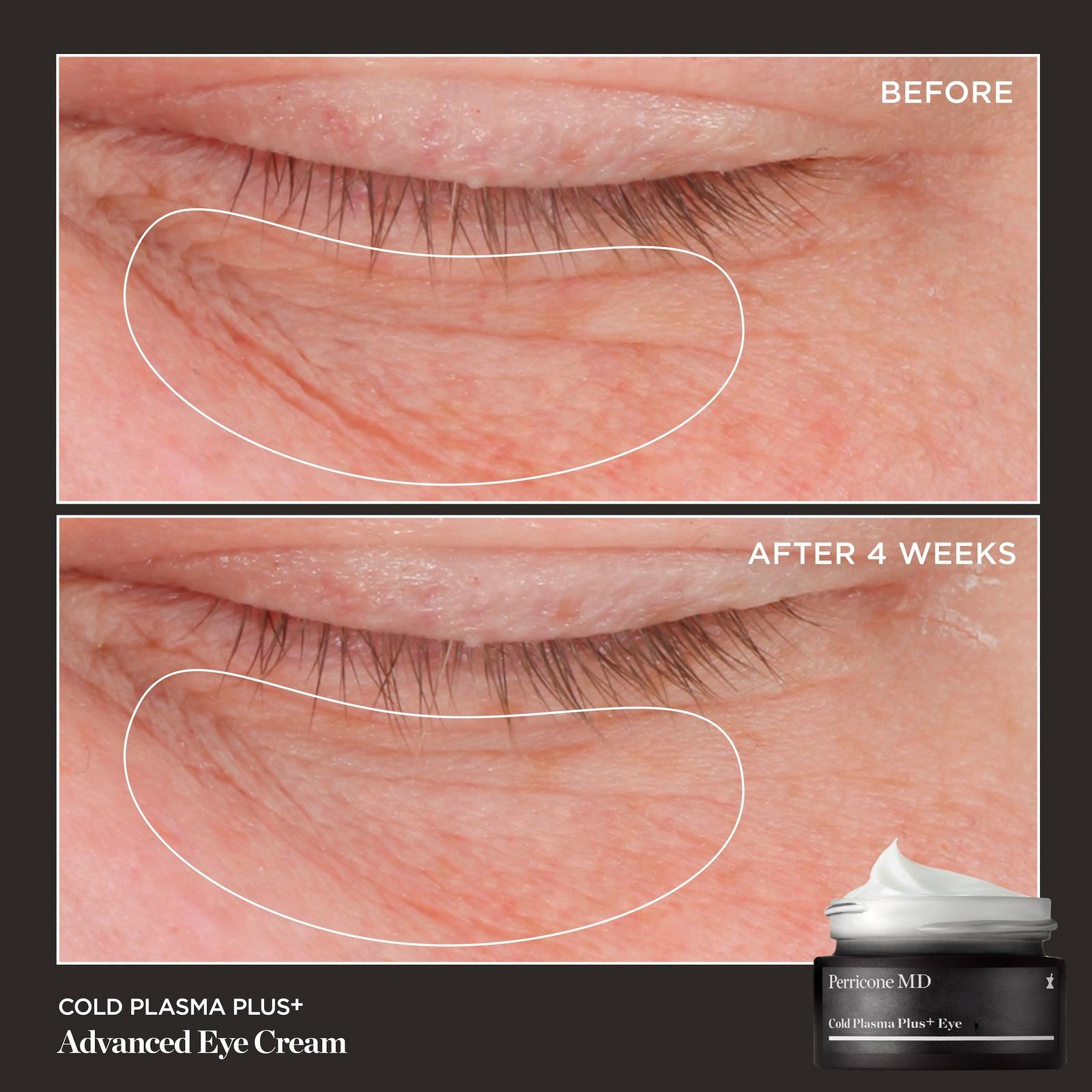 Cold Plasma Plus+ Power Quad