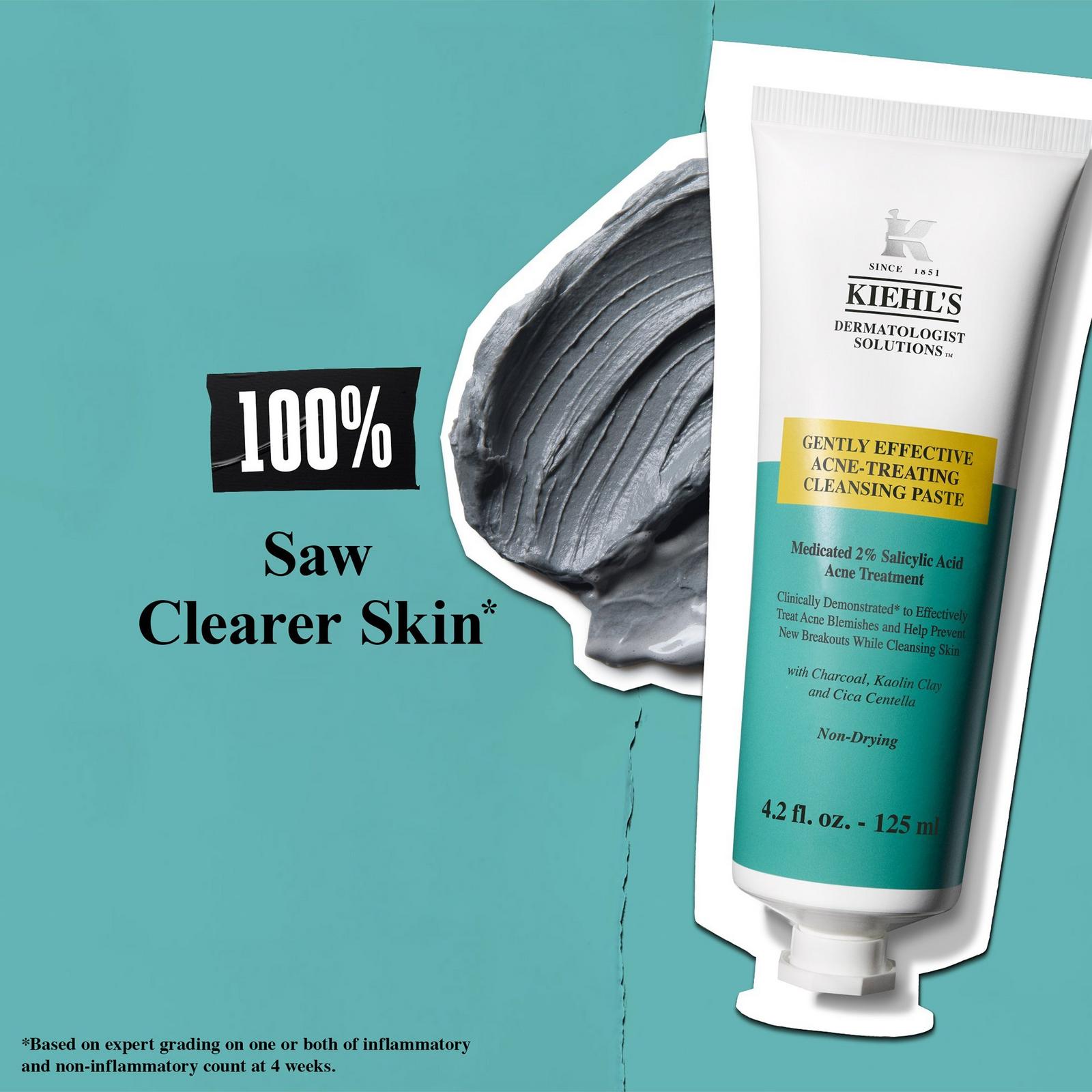 Acne-Treating Cleansing Paste