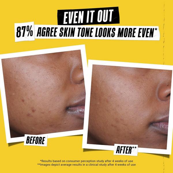 Kiehl's Since 1851 Better Screen UV Serum Sunscreen SPF 50+ #6