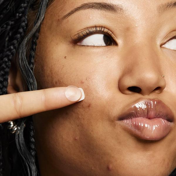 e.l.f. Cosmetics Blemish Breakthrough Stick It to Zits Pimple Patches #5