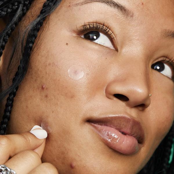 e.l.f. Cosmetics Blemish Breakthrough Stick It to Zits Pimple Patches #6