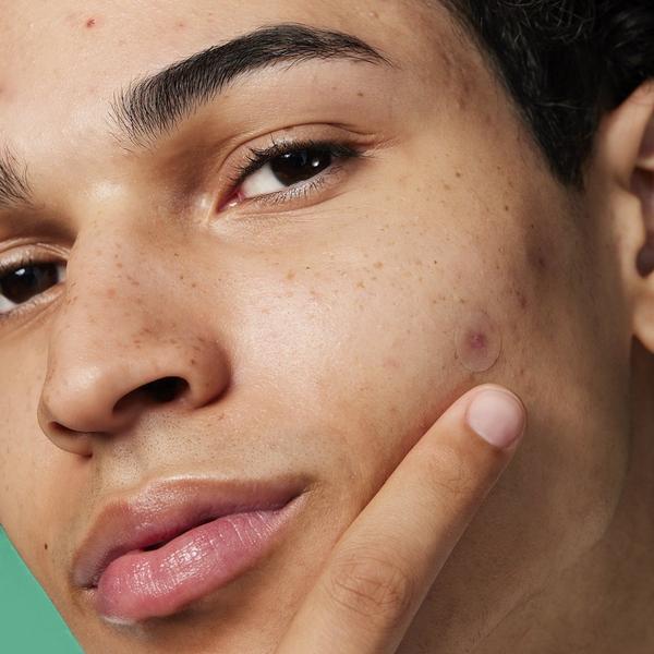 e.l.f. Cosmetics Blemish Breakthrough Stick It to Zits Pimple Patches #7