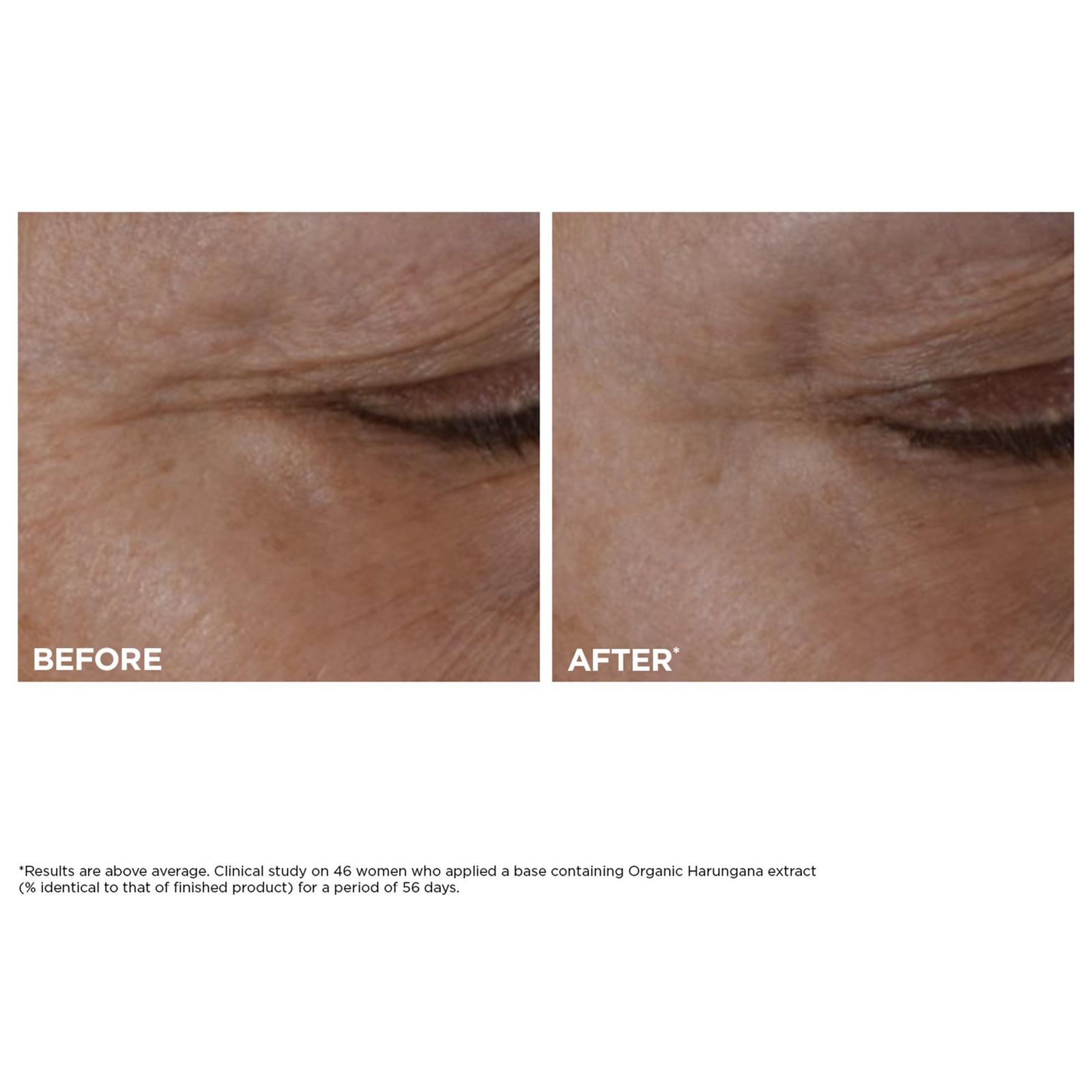 Total Eye Lift Eye Cream - 0.5 oz
