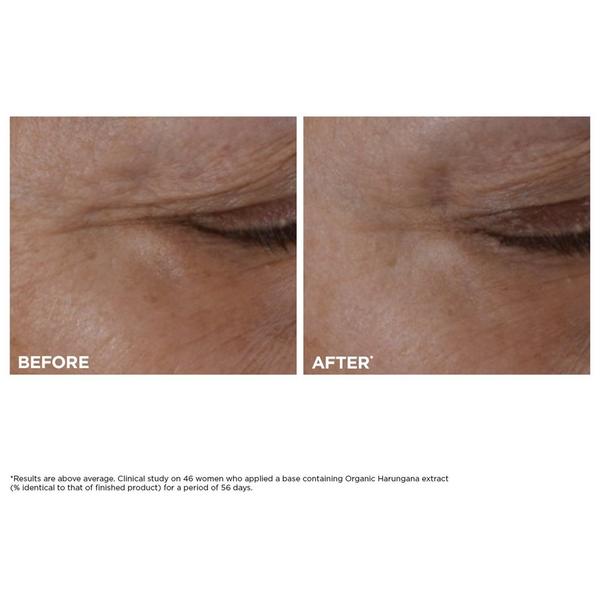 Crema de ojos recargable Total Eye Lift 3