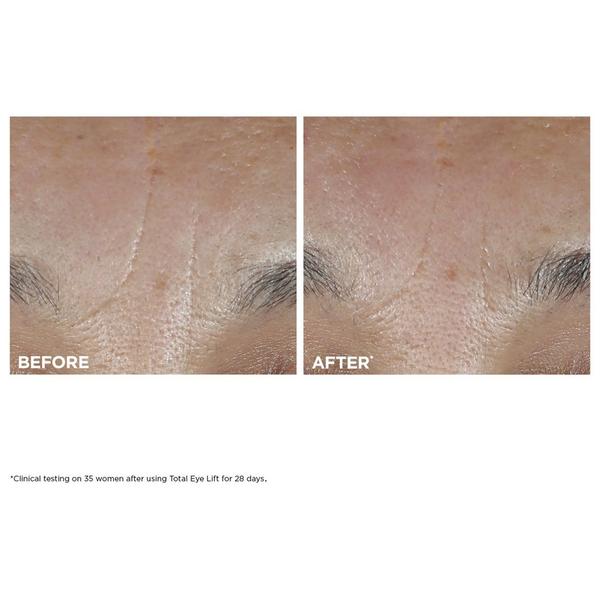 Crema de ojos recargable Total Eye Lift 4