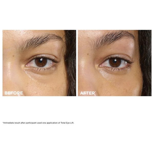 Crema de ojos recargable Total Eye Lift 5