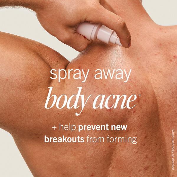 First Aid Beauty Body Acne Clearing Mist #2